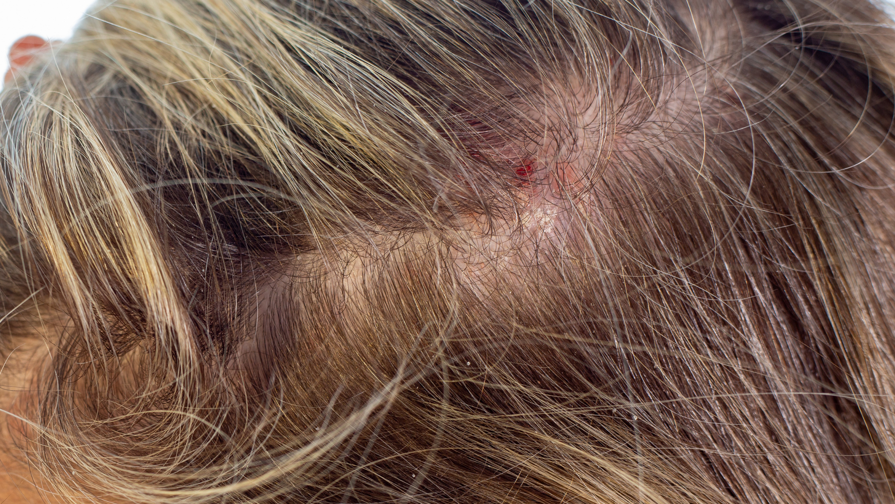If Your Scalp Stings, Itches or Feels Tight — This Is Why