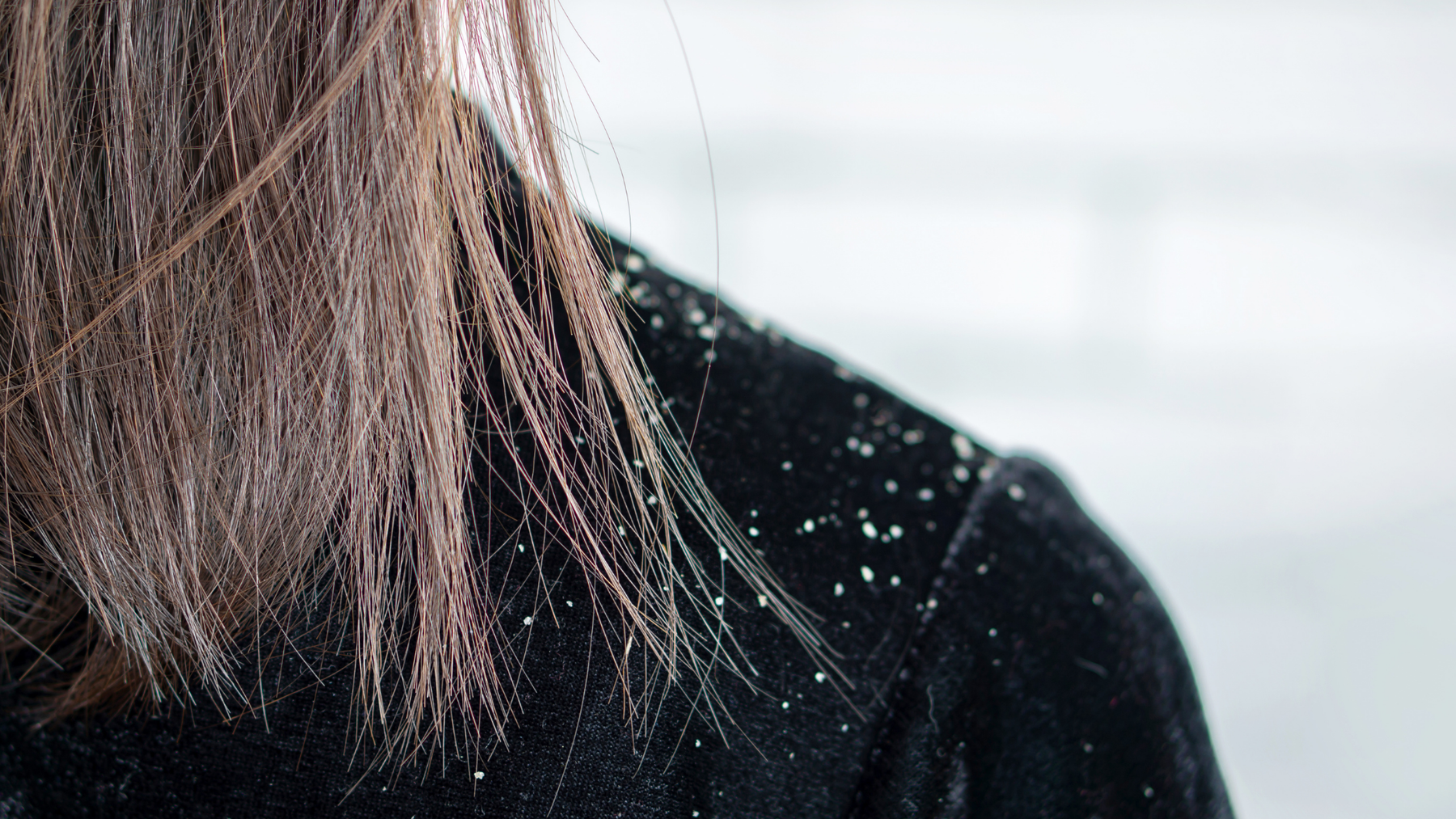 Winter Hair Damage Explained: Hats, Beanies and Friction