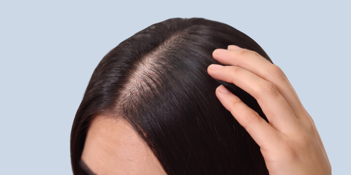 Hair Loss — brand hero