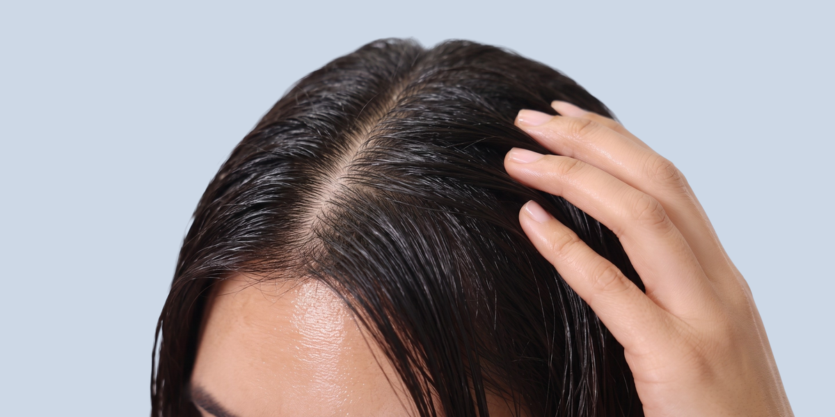 Oily Scalp — brand hero